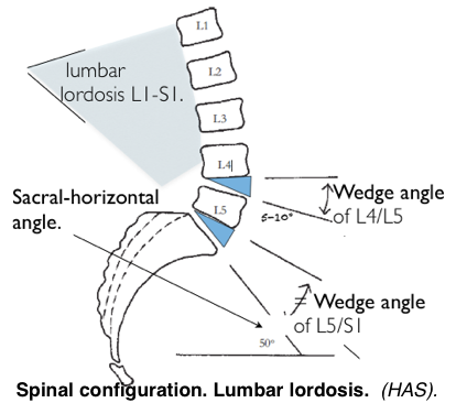 Lumbar lordosis angles