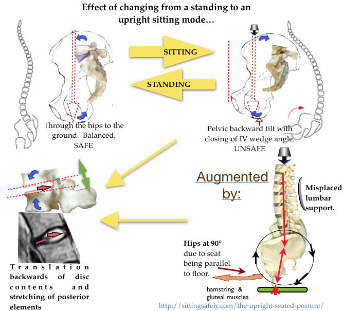 Effect of sitting